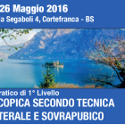 SUTURA LAPAROSCOPICA SECONDO TECNICA DI ACCESSO LATERALE E SOVRAPUBICO SUTURA LAPAROSCOPICA SECONDO TECNICA DI ACCESSO LATERALE E SOVRAPUBICO